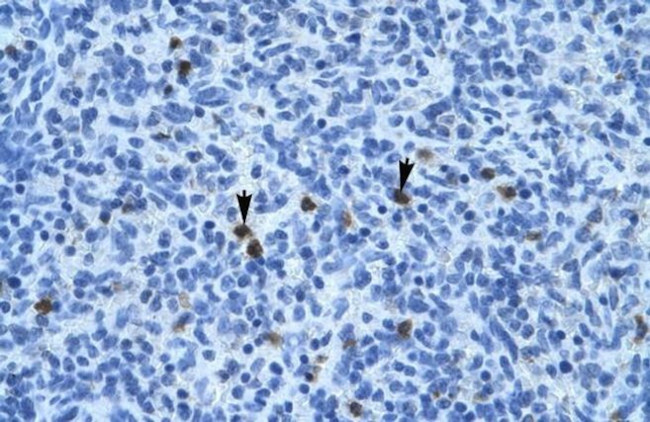 Annexin A3 Antibody in Immunohistochemistry (IHC)