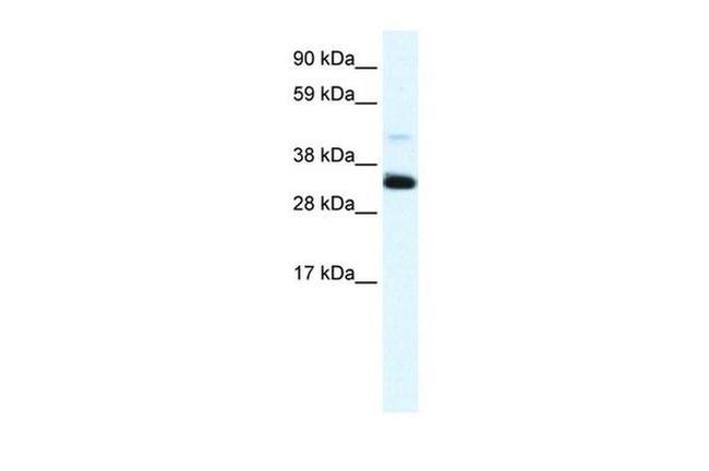 Annexin A3 Antibody in Western Blot (WB)