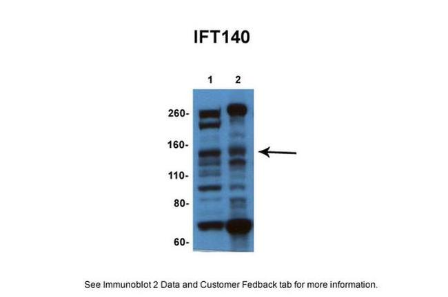 IFT140 Antibody in Western Blot (WB)