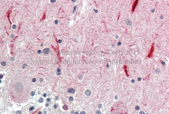 GABRG2 Antibody in Immunohistochemistry (Paraffin) (IHC (P))