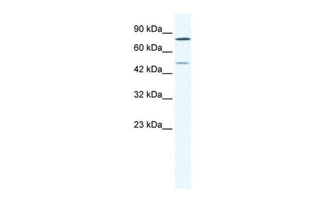 ZNF12 Antibody in Western Blot (WB)