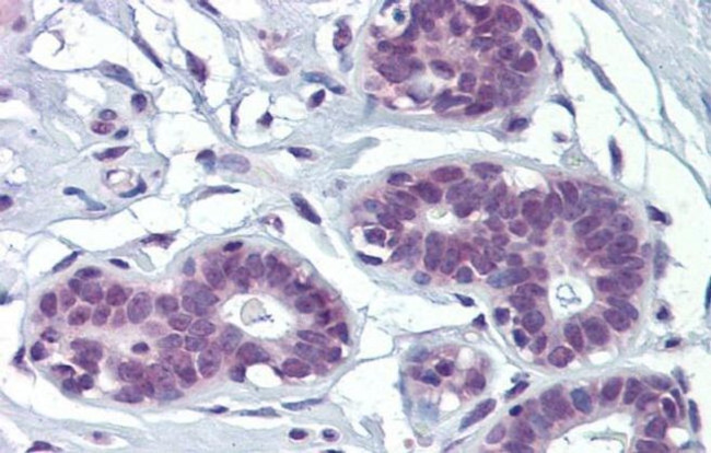 MAZ Antibody in Immunohistochemistry (IHC)