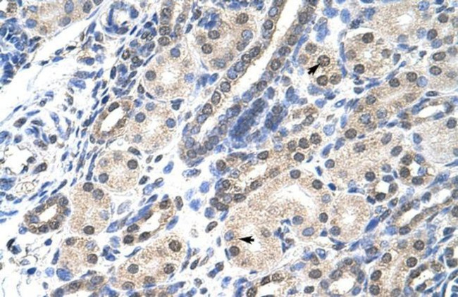 MSX2 Antibody in Immunohistochemistry (IHC)