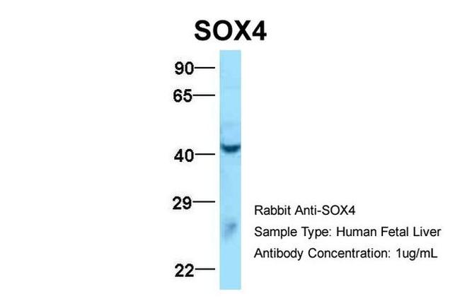 SOX4 Antibody in Western Blot (WB)