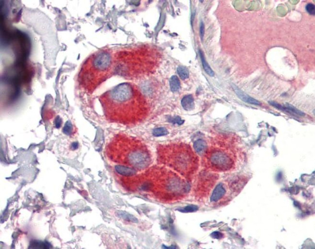 ZFP36 Antibody in Immunohistochemistry (Paraffin) (IHC (P))