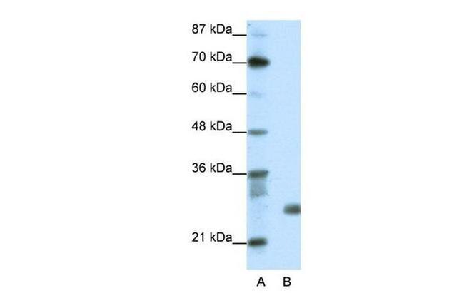 SAP30 Antibody in Western Blot (WB)