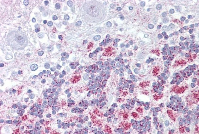 E2F2 Antibody in Immunohistochemistry (IHC)