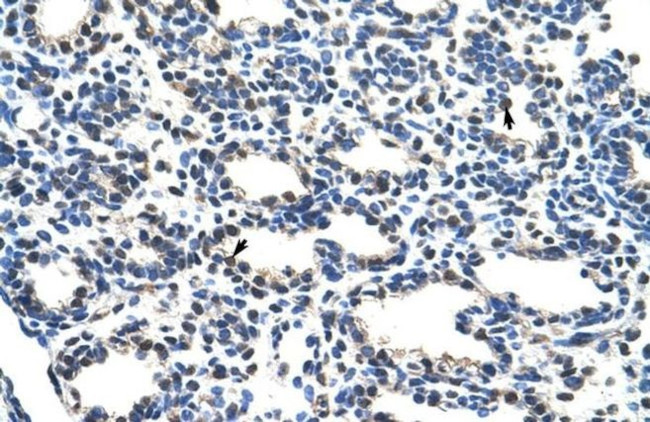 NRF1 Antibody in Immunohistochemistry (IHC)