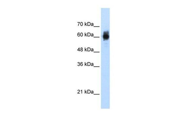 NRF1 Antibody in Western Blot (WB)