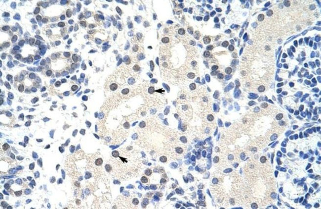 FOXG1 Antibody in Immunohistochemistry (IHC)