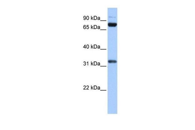 TAF6 Antibody in Western Blot (WB)