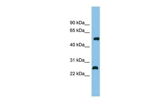 MEF2D Antibody in Western Blot (WB)