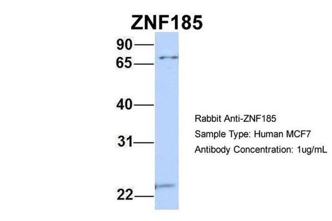 ZNF185 Antibody in Western Blot (WB)