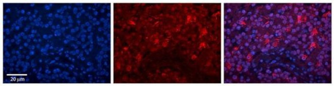 ILF3 Antibody in Immunohistochemistry (Paraffin) (IHC (P))