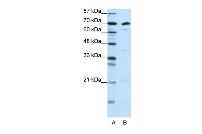 ILF3 Antibody in Western Blot (WB)