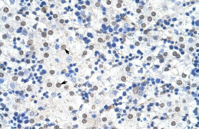 IKZF3 Antibody in Immunohistochemistry (IHC)