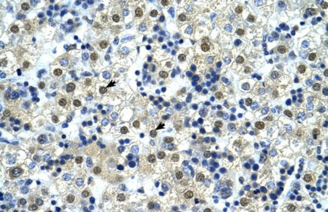 NFYC Antibody in Immunohistochemistry (IHC)