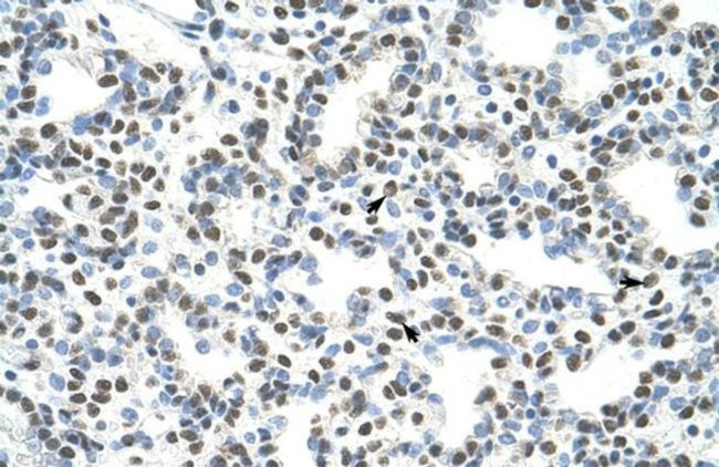 AKAP8L Antibody in Immunohistochemistry (IHC)