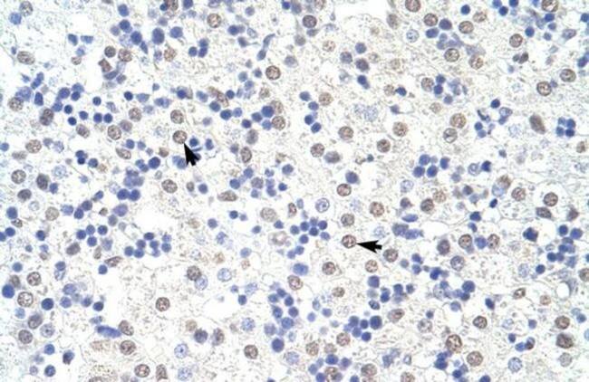 SART3 Antibody in Immunohistochemistry (IHC)