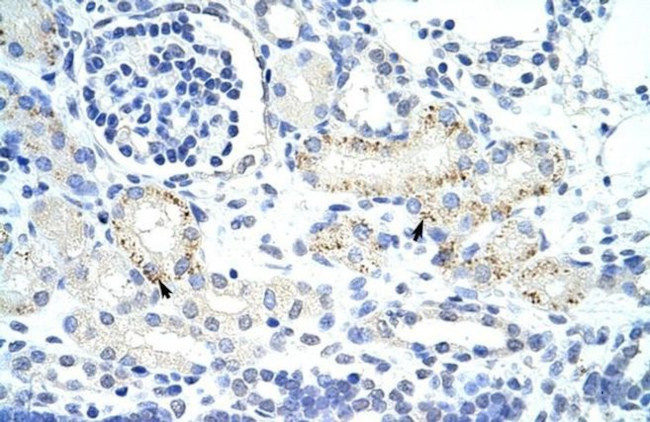 GTF2IRD1 Antibody in Immunohistochemistry (IHC)