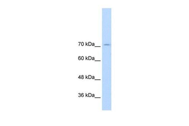 GTF2IRD1 Antibody in Western Blot (WB)