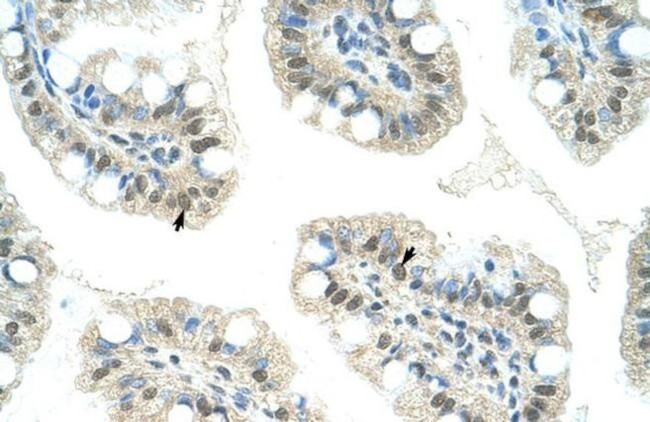 JMJD2D Antibody in Immunohistochemistry (IHC)