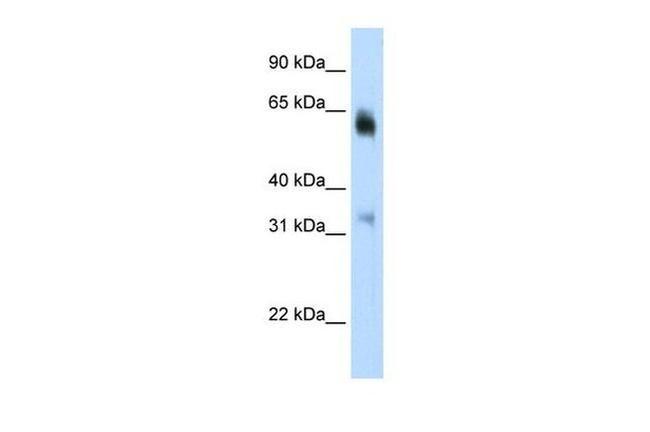 JMJD2D Antibody in Western Blot (WB)