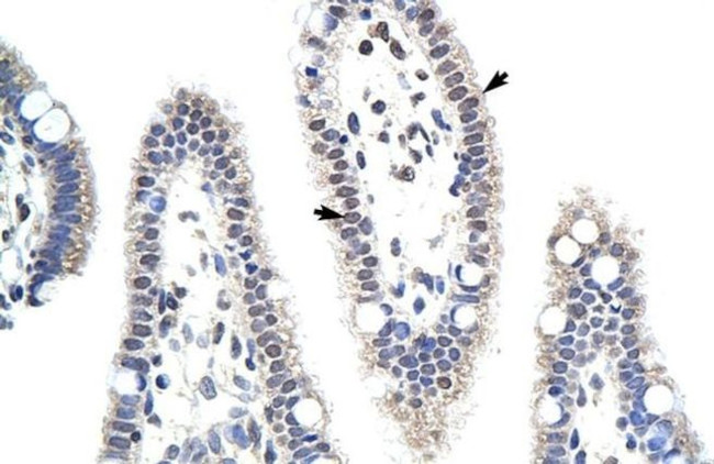 USE1 Antibody in Immunohistochemistry (IHC)