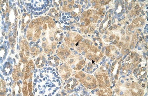 NR2F2 Antibody in Immunohistochemistry (IHC)