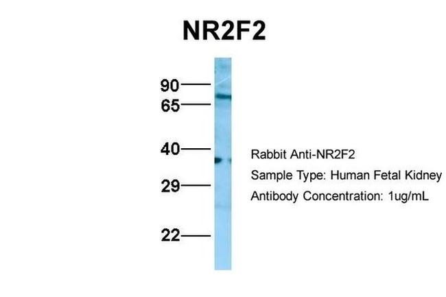 NR2F2 Antibody in Western Blot (WB)