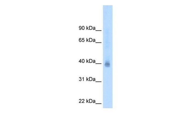 NR2F2 Antibody in Western Blot (WB)