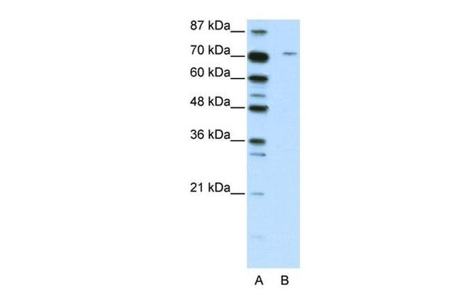 LZTS1 Antibody in Western Blot (WB)