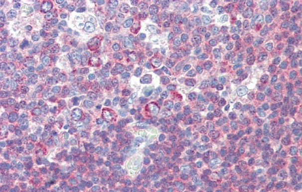 BACH2 Antibody in Immunohistochemistry (IHC)