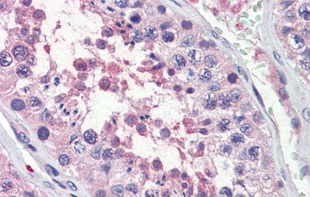 TRIM8 Antibody in Immunohistochemistry (IHC)