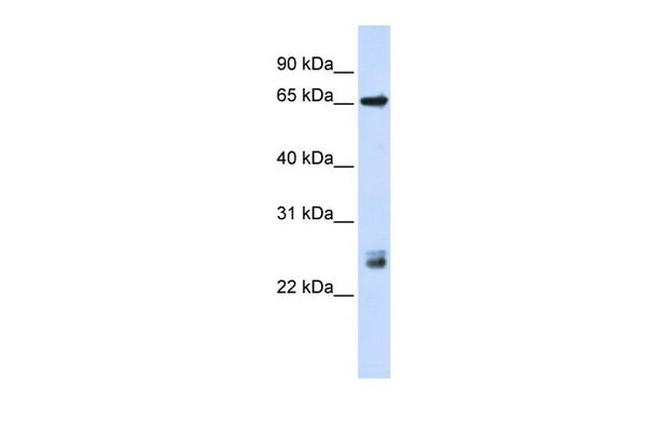 TRIM8 Antibody in Western Blot (WB)