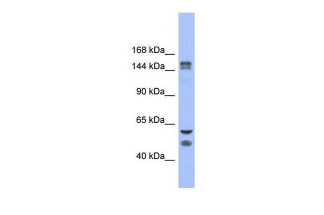 FBXL10 Antibody in Western Blot (WB)