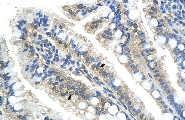 NAC1 Antibody in Immunohistochemistry (IHC)