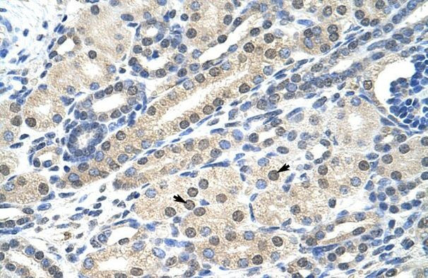 NAC1 Antibody in Immunohistochemistry (IHC)