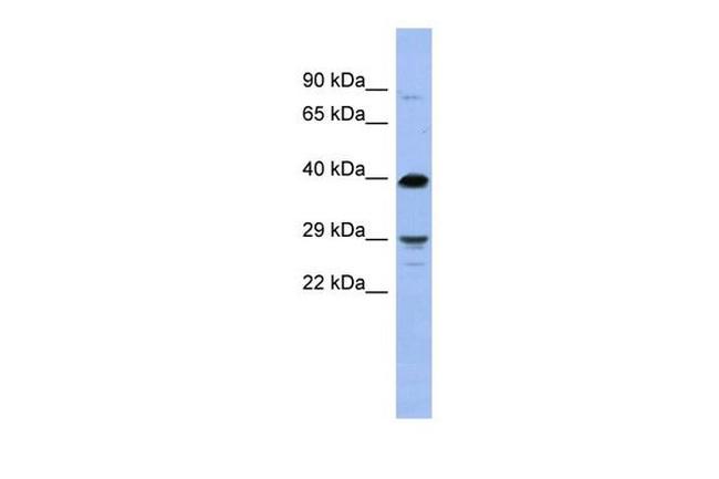 OLIG3 Antibody in Western Blot (WB)