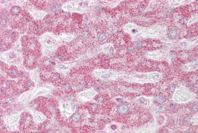 INSIG1 Antibody in Immunohistochemistry (IHC)