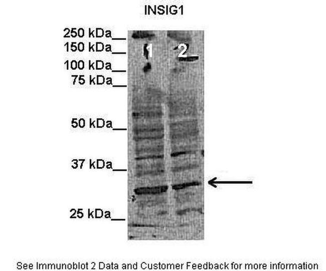 INSIG1 Antibody in Western Blot (WB)