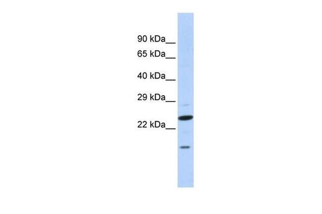 INSIG2 Antibody in Western Blot (WB)