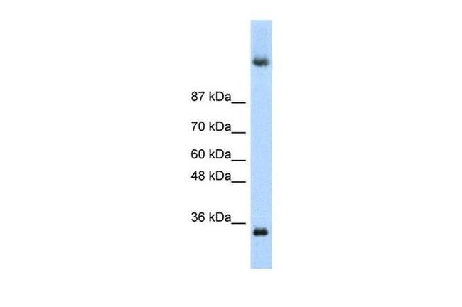 DAZ4 Antibody in Western Blot (WB)