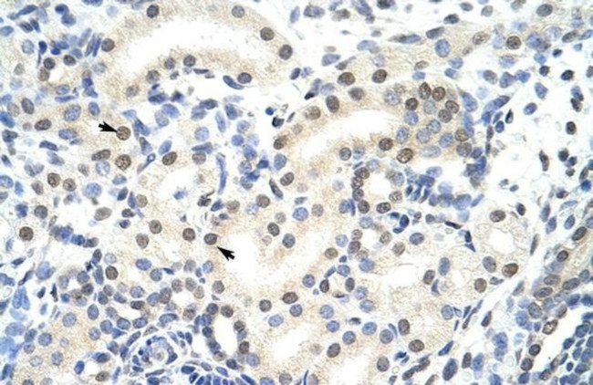 SNRNP70 Antibody in Immunohistochemistry (Paraffin) (IHC (P))
