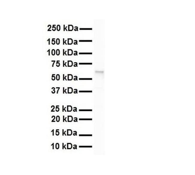 SNRNP70 Antibody in Western Blot (WB)