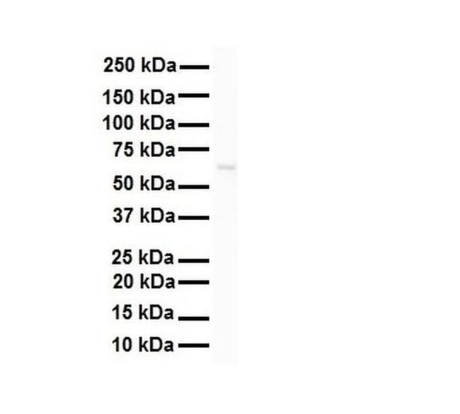 SNRNP70 Antibody in Western Blot (WB)