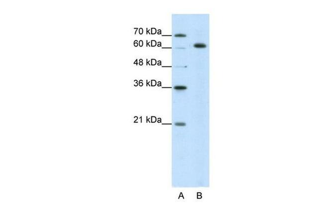 SNRNP70 Antibody in Western Blot (WB)