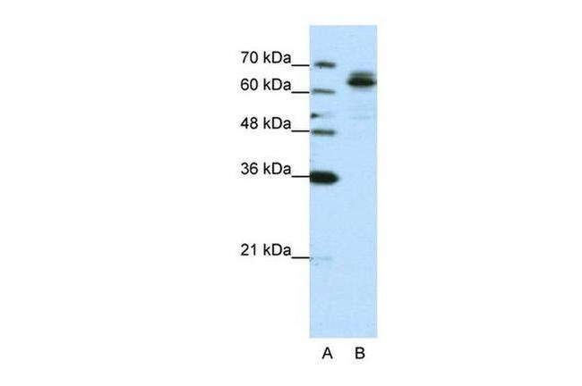 FXR1 Antibody in Western Blot (WB)