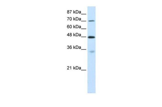 CARS Antibody in Western Blot (WB)