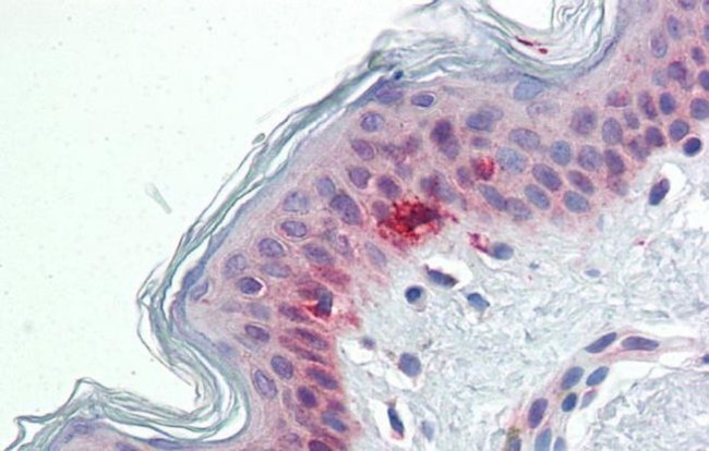 RAE1 Antibody in Immunohistochemistry (Paraffin) (IHC (P))